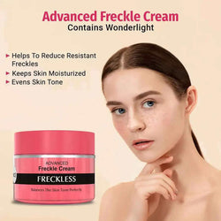Vince Advanced Freckle Cream 50ml
